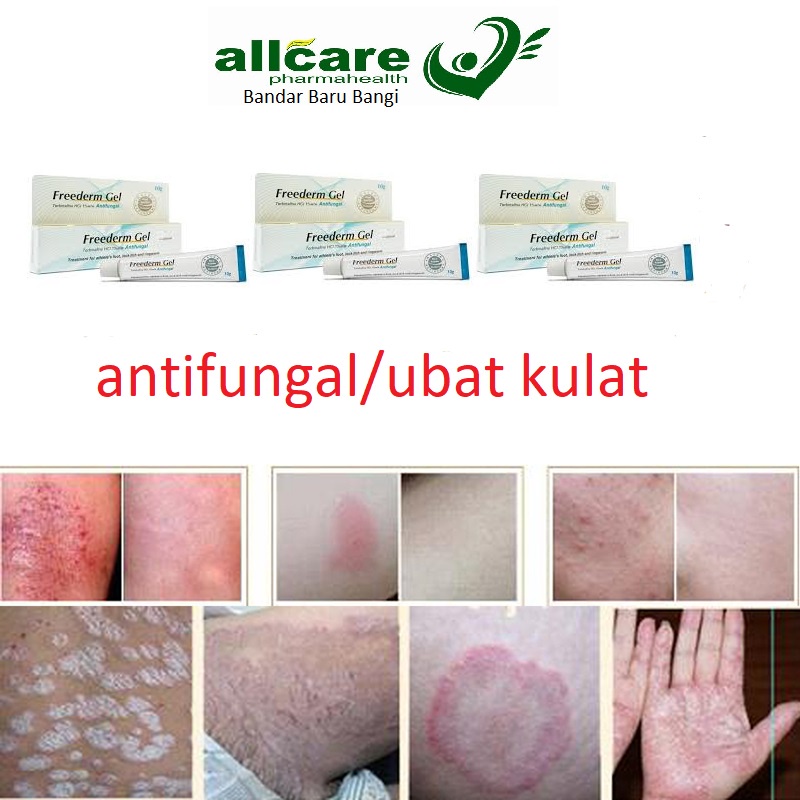 Freederm Antifungal Ubat Kulat Gel 10g Shopee Malaysia