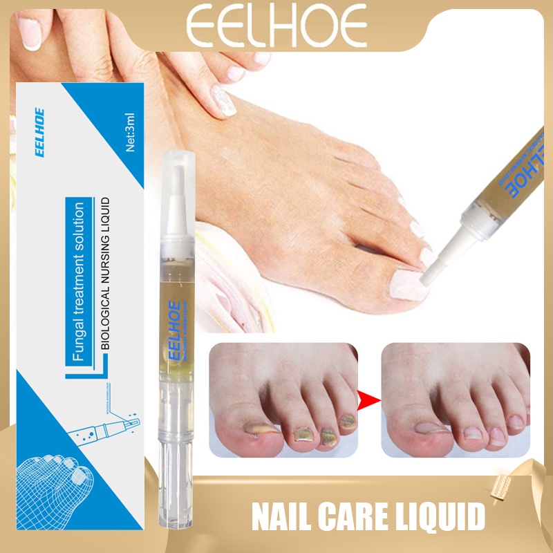 Eelhoe Fungal Treatment Solution Nail Essence Serum Repair Fingernail