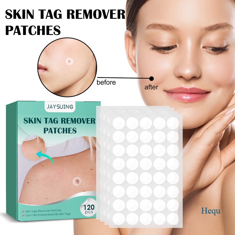 Hequ Pc Box Warts Remover Patch Skin Tags Pimple Treatments Cream