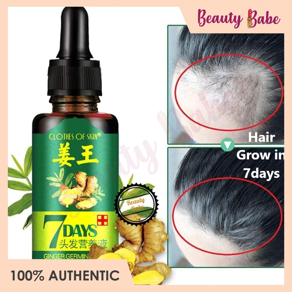 Ginger King Germinal Oil Ginger Hair Growth Essence Hair Growth Serum