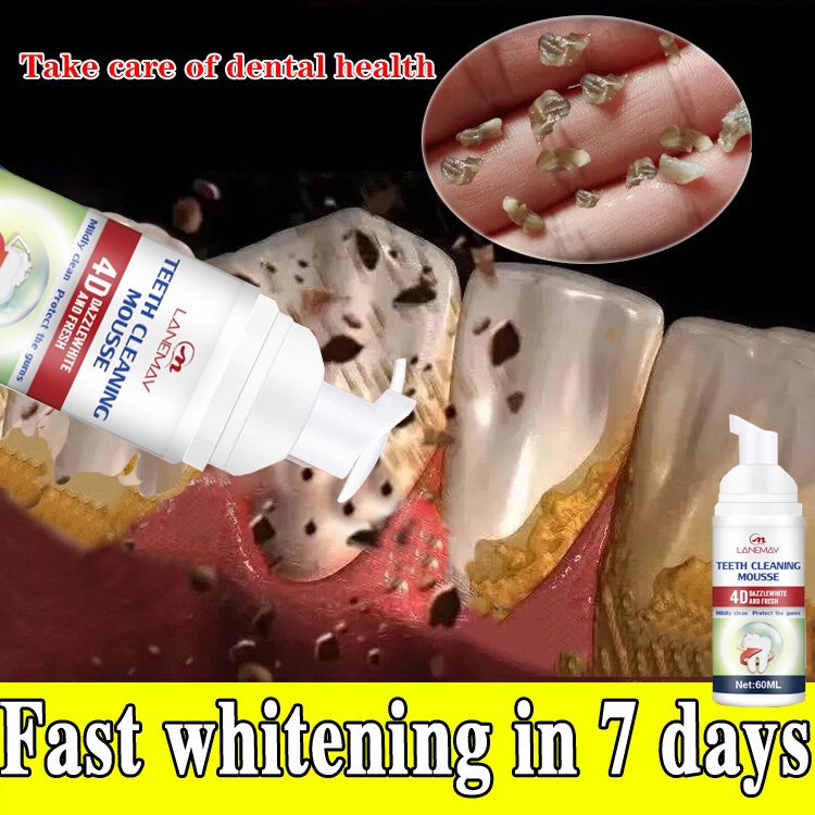 Teeth Pain Spray Toothache Spray Ml Clean The Mouth Fresh Breath