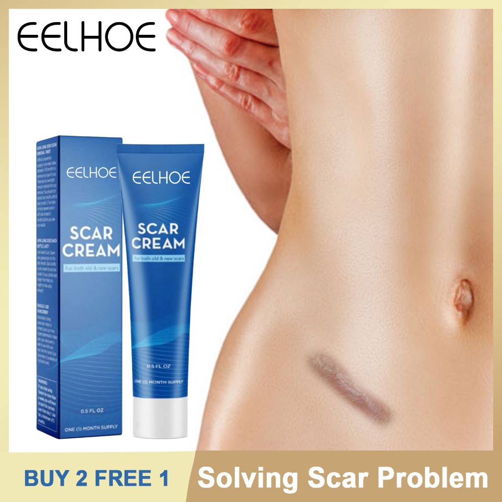 Buy Get Freeeelhoe Scar Removal Cream Repair Old Scars Krim