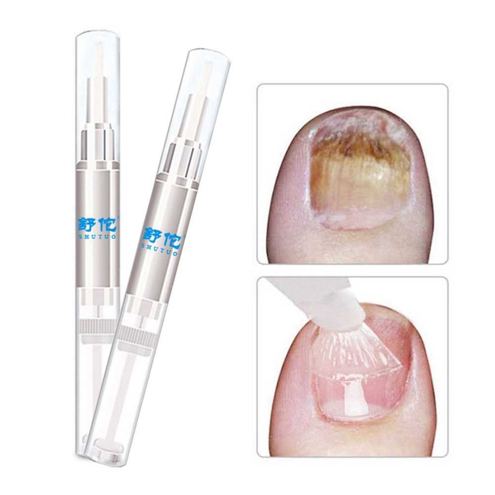 5Pcs 3ML Fungal Nail Treatment Pen Onychomycosis Paronychia Anti Fungal