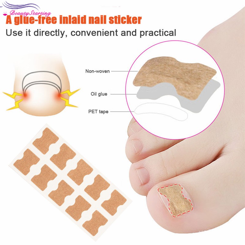 BT Nail Correction Sticker Ingrown Toenail Corrector Stickers