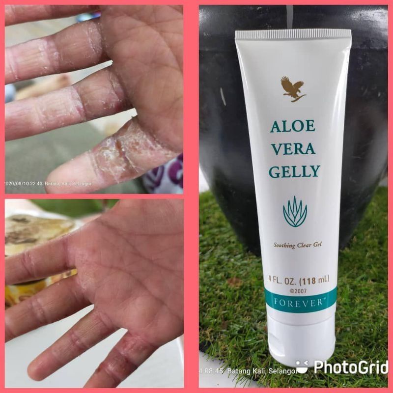 Aloe Vera Gelly Forever Living 118ml Tube Kulit Bakar Sensitif Luka