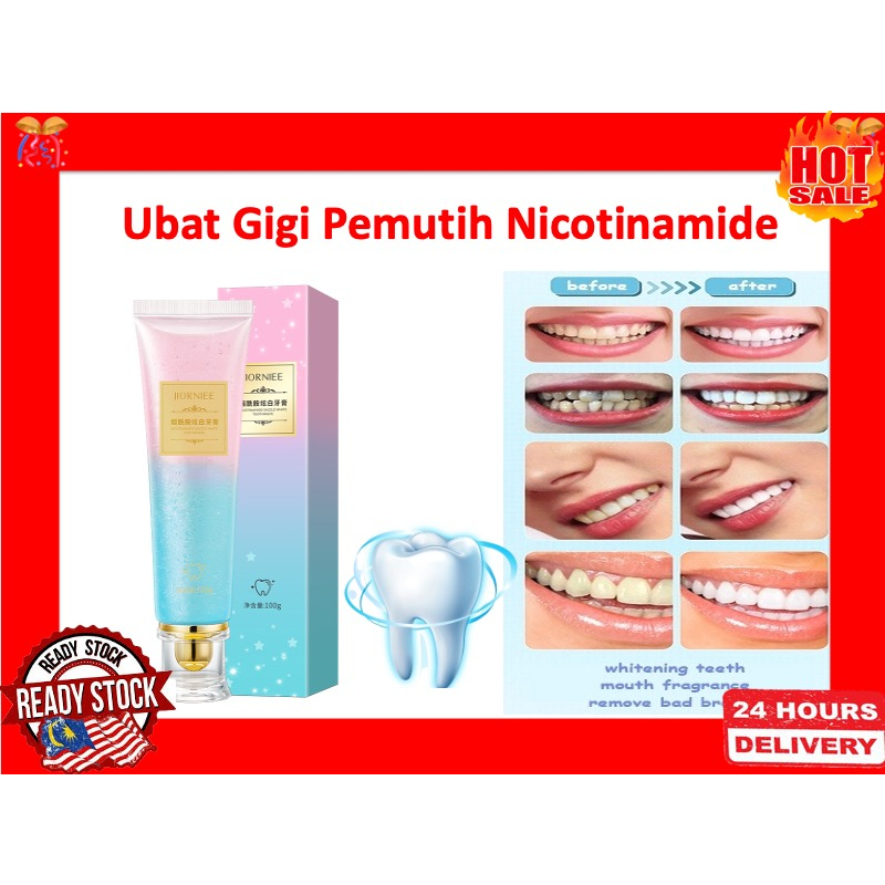 Ubat Gigi Teeth Whitening Gigi Putih Whitening Toothpaste Teeth White