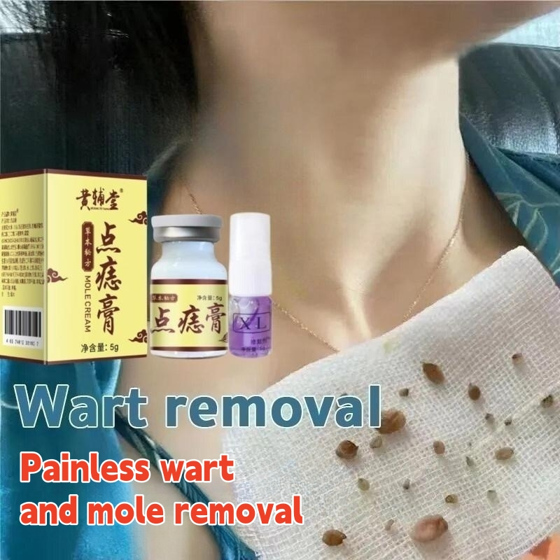 Mole Remover Cream Ubat Kutil Tahi Lalat Ketuat Dan Biji Kolesterol