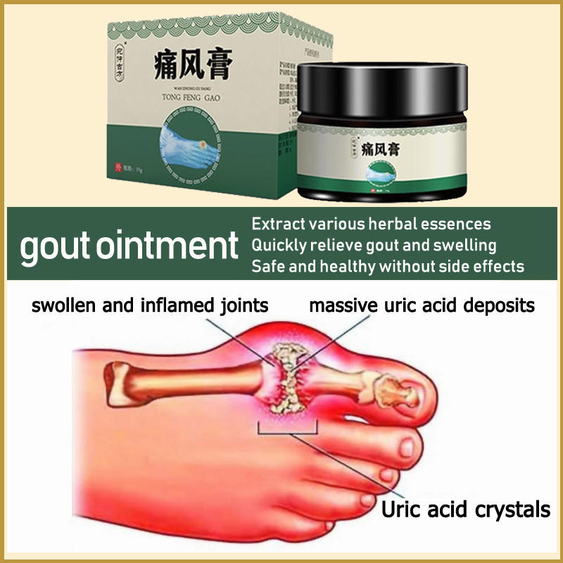 Gout Ointment Osteoarthritis Joint Pain Painkiller Ubat Gout Treatment