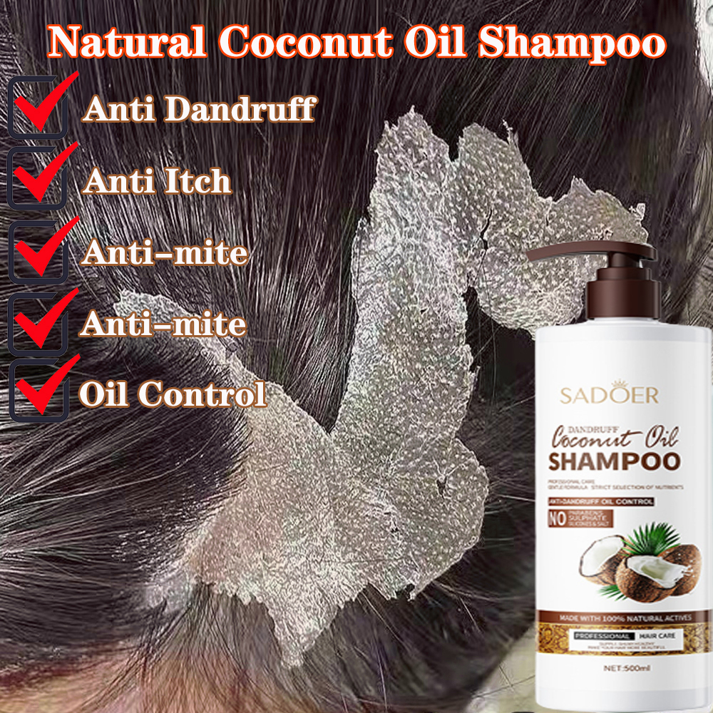 Anti Dandruff Shampoo Kelemumur Oil Control Anti Itch Refreshing Scalp