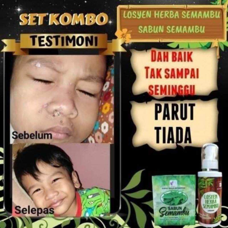 SET SEMAMBU SABUN SEMAMBU SUSUK MANJA LOSYEN SEMAMBU NEEM CHICKEN POX