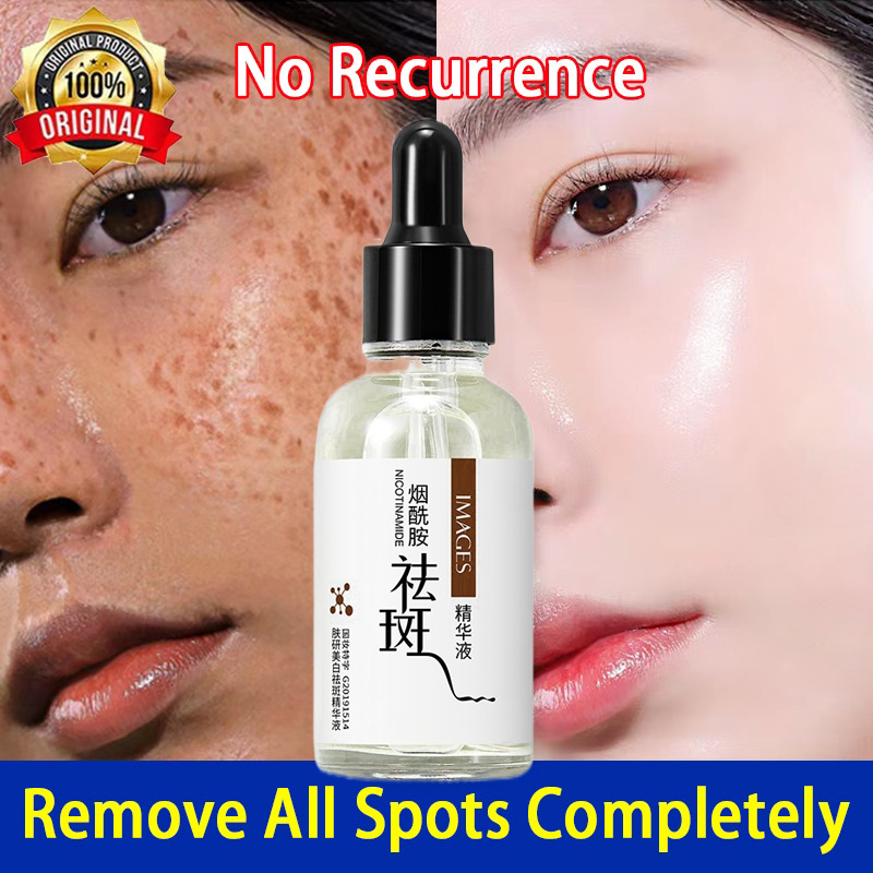 Anti Freckles Whitening Serum Niacinamide Freckle Removing Serum