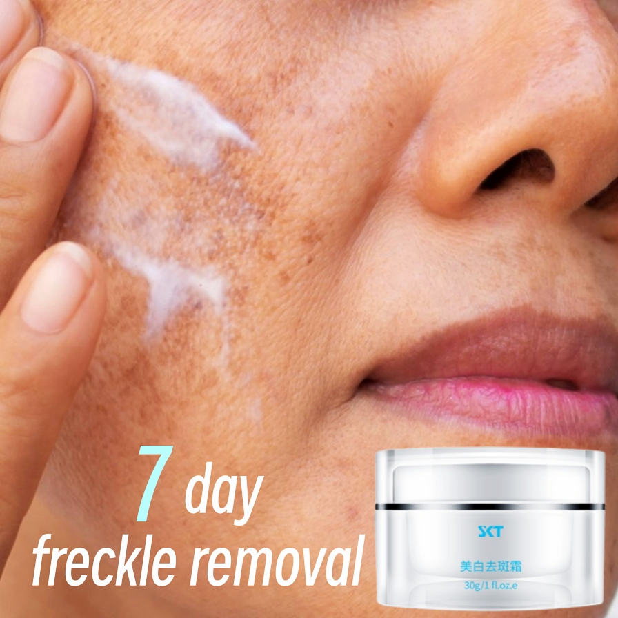 Krim Jeragat Paling Berkesan Whitening Freckle Cream Pemutih Muka