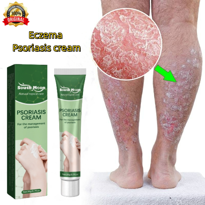 Psoriasis Eczema Cream Ubat Kulit Gatal Ekzema Antifungal Antibacterial