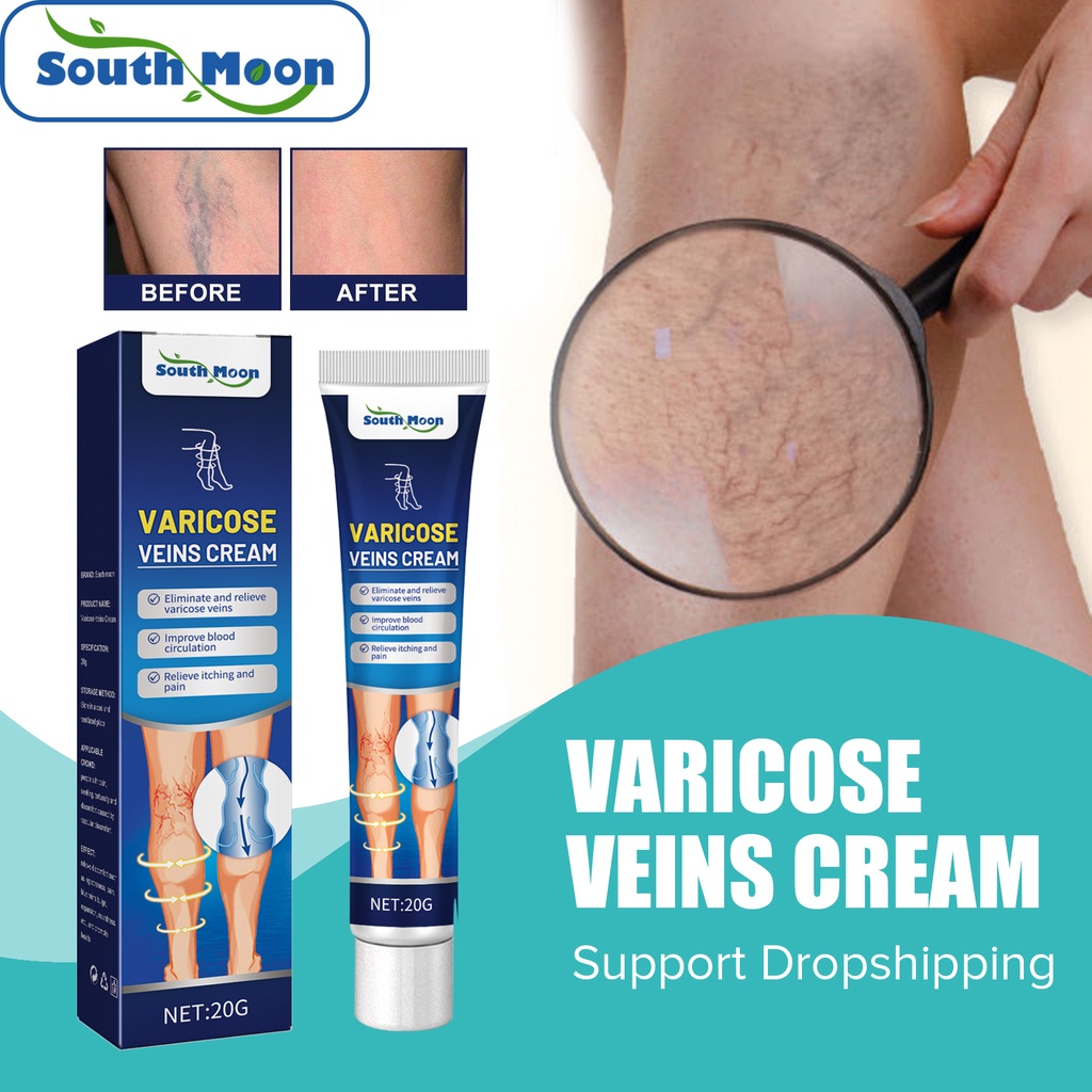 South Moon 20g Varicose Veins Cream Vasculitis Phlebitis Spider Pain