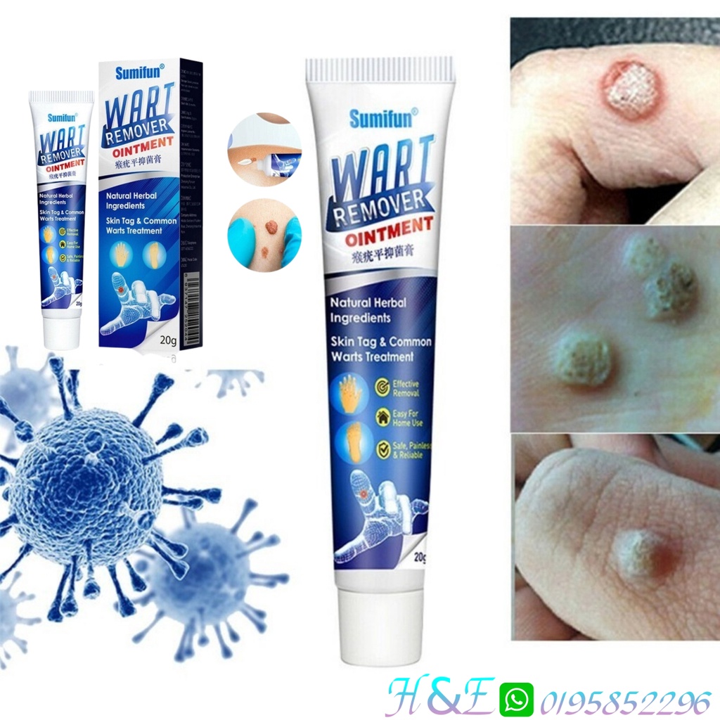 Wart Removal Sumifun Body Warts Treatment Cream Buang Tahi Lalat