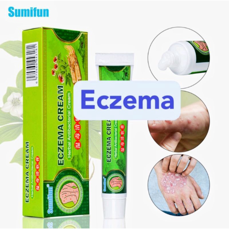 Ubat Gatal Kulit Ekzema Berkesan Eczema Cream Ubat Gatal Cina Sumifun