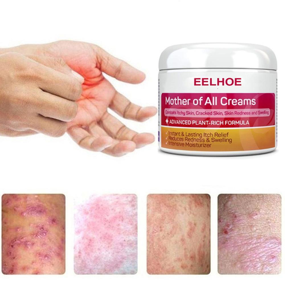 EELHOE Mother Of All Creams Skin Topical Eczema Anti Itch Cream Make