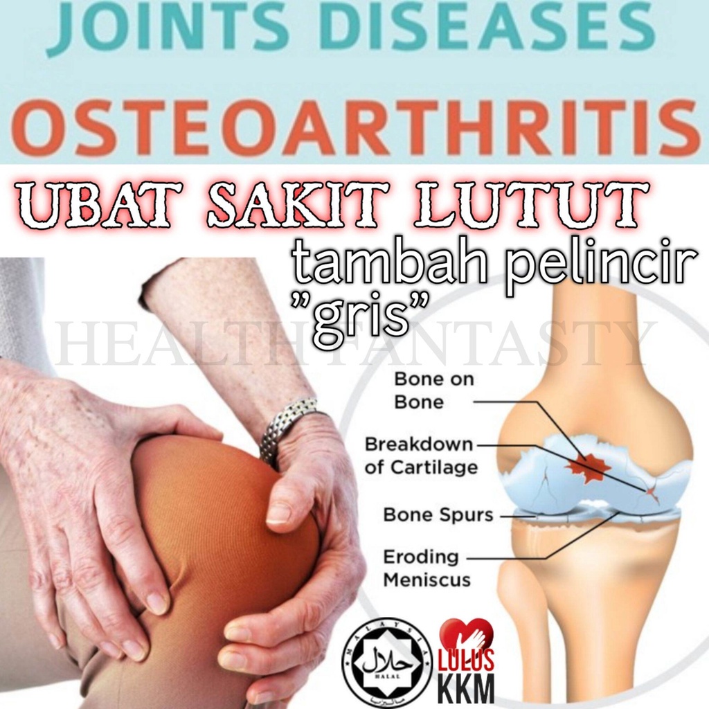 Arthritis Osteoarthritis Adjunctive Therapy Sendi Dan Cecair Sendi