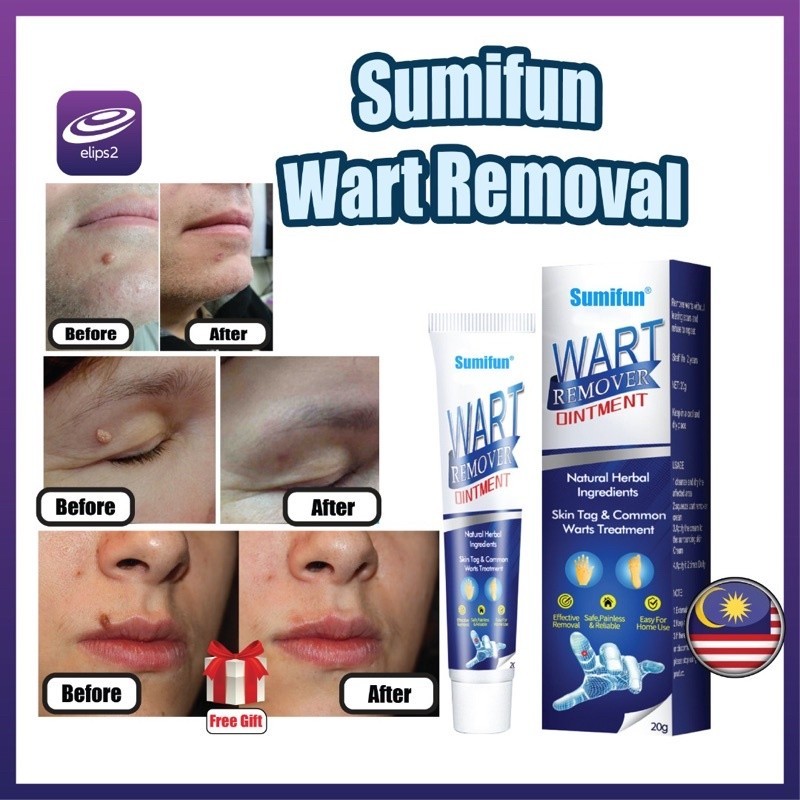 Sumifun Wart Removal Body Warts Treatment Cream Skin Tag Remover