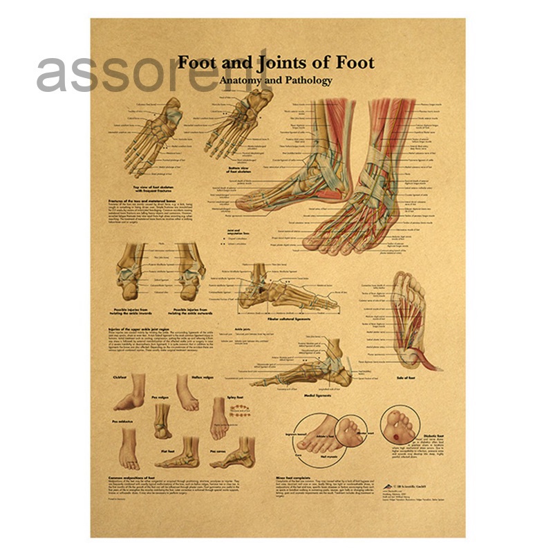 assorent Foot Joints of Foot Chart Anatomy Pathology Poster Canvas ...