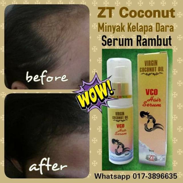 (READY STOCK) ORIGINAL VCO HAIR SERUM - SERUM RAMBUT - MINYAK KELAPA ...