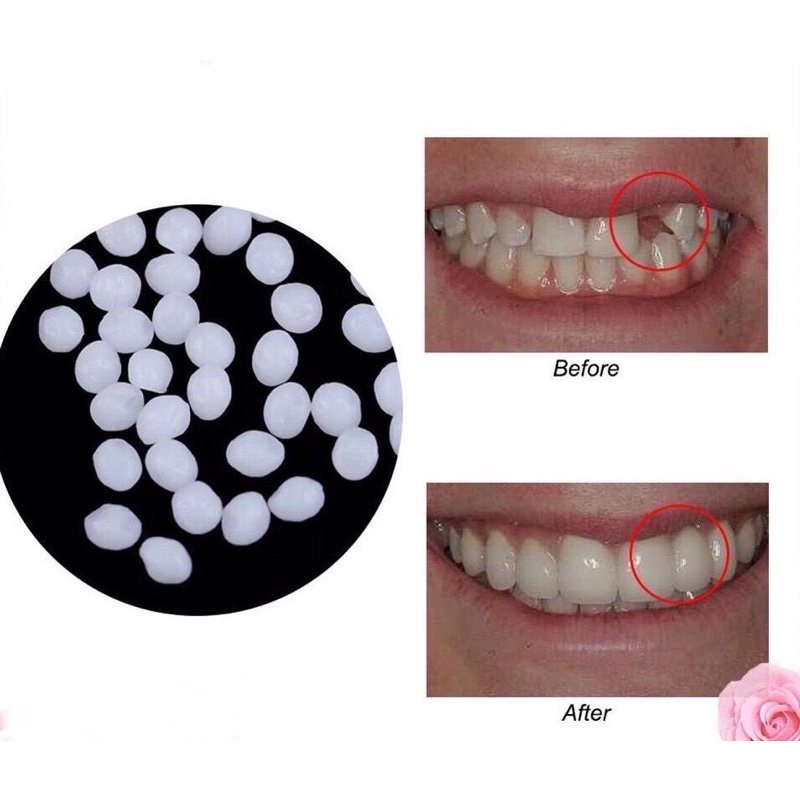 GIGI PALSU TEMPTOOTH false teeth boleh kunyah makanan dentures replace ...