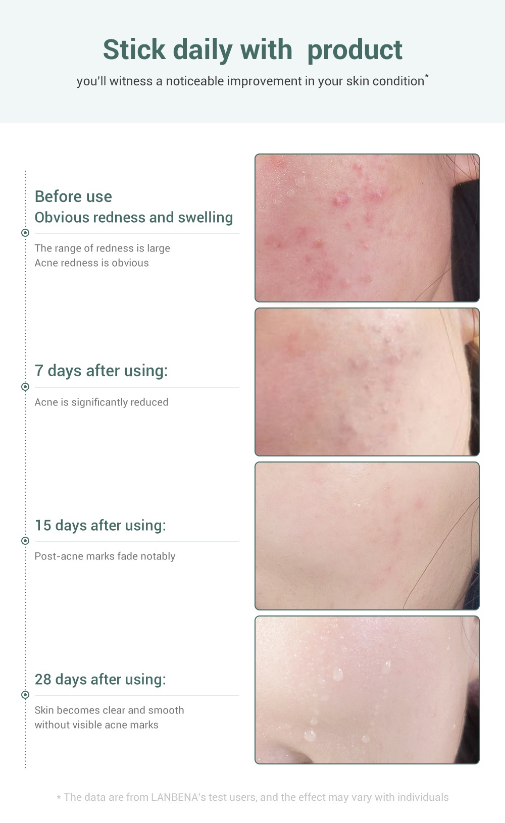 🔥Clearance🔥LANBENA acne control Cream - Acne Spot Prone Gel Remove ...