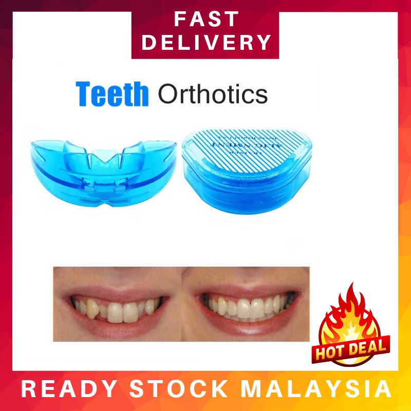 🔥 𝐑𝐄𝐀𝐃𝐘 𝐒𝐓𝐎𝐂𝐊 🔥Perangkap Gigi/Orthodontic Trainer Dental Tooth ...