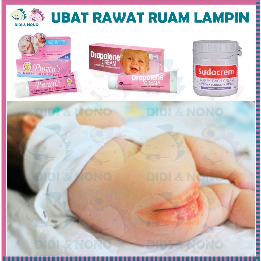 Ubat baby Rawat Luam Lampin Nappy Cream Rash ,nappy liner and nappy ...