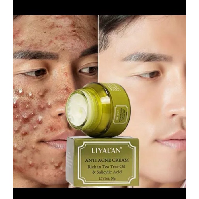 LIYALAN CREAM BEST . Shopee Malaysia