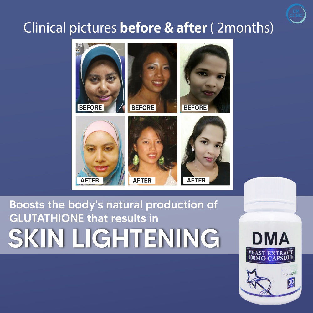 DM Aesthetics SKIN WHITENING Supplement 30 Vegetarian Capsules