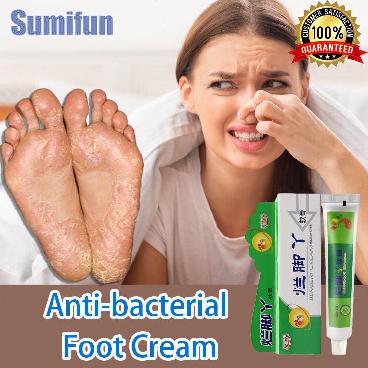 Antifungal treatment cream Remove athlete's foot fungus Foot care