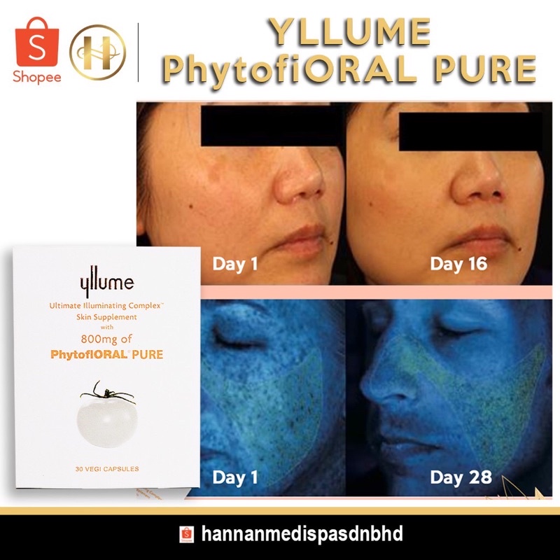 YLLUME PHYTOFLORAL PURE HANNAN SUPPLEMENT Shopee Malaysia