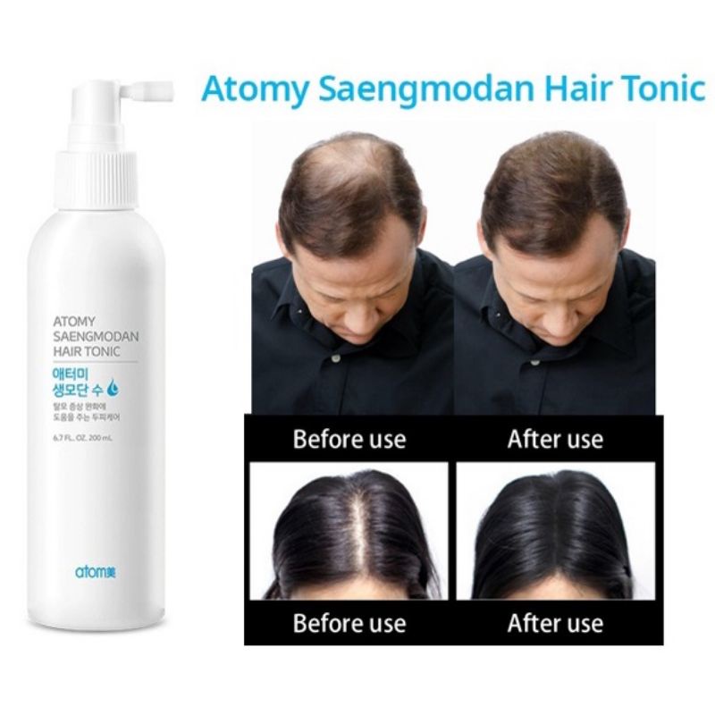 Saengmodan Hair Tonic (200ml) KOREA (Hair Loss Prevention) Shopee