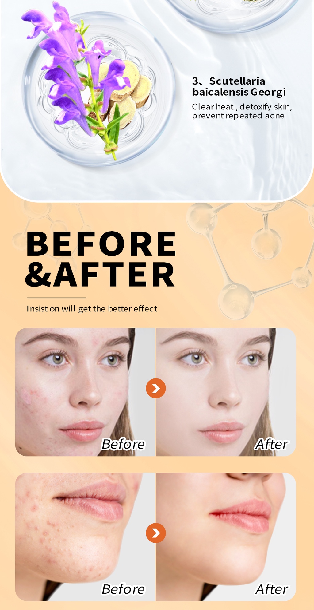 Meiyanqiong Skin Care Acne Cleaning Cream Remove Repair Comedone Pimple Acne Quickly Face Acne 0214