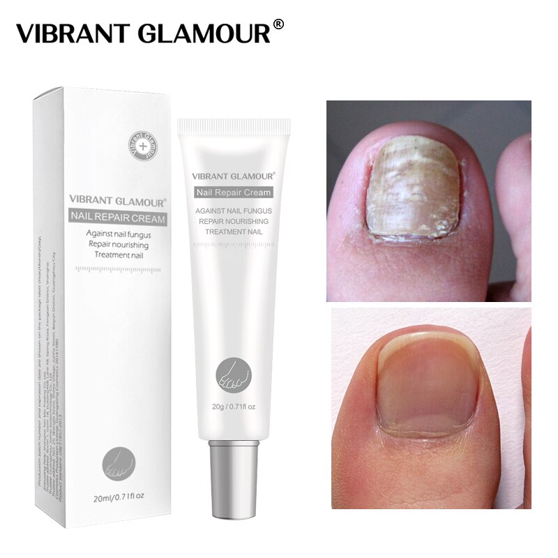 VIBRANT GLAMOUR Nail Repair Cream Nail Antifungal Treatment Onychomycosis Removal Shopee Malaysia
