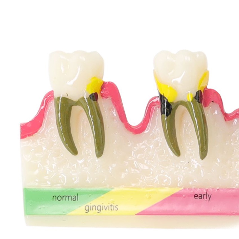 Dental Periodontal Model Tooth Study Teaching Model for School /Lab ...