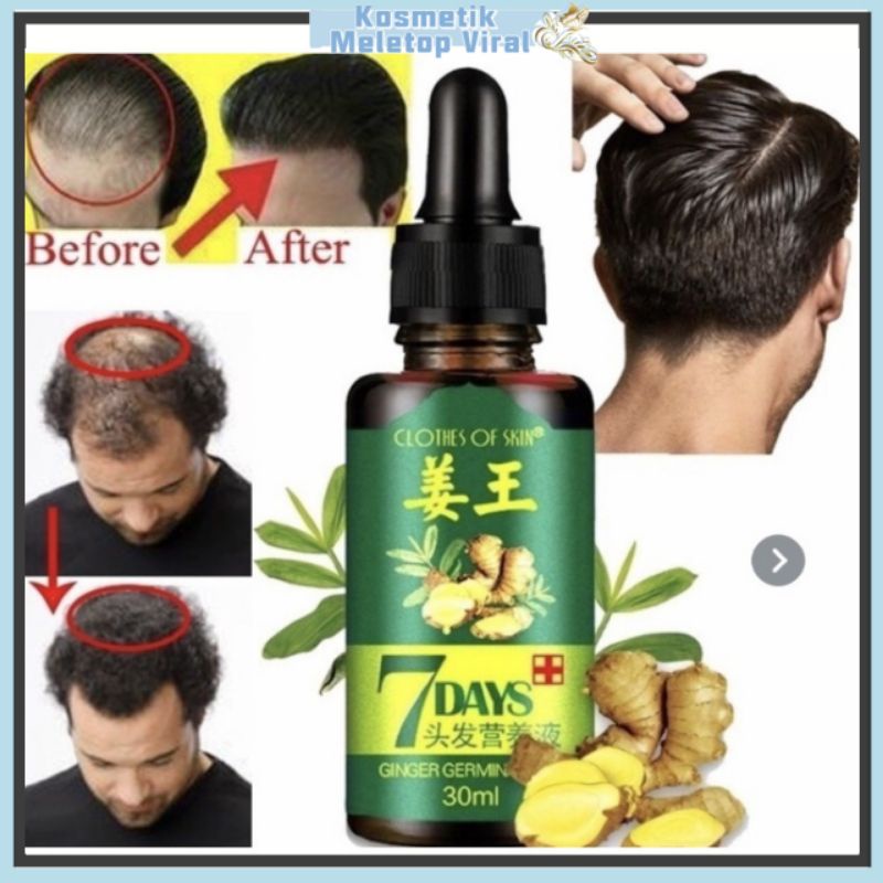 7days Ginger Germinal Oil Clothes Of Skin Hair Growth Oil Original 头发生长 Tonic Rambut Ginger 0467