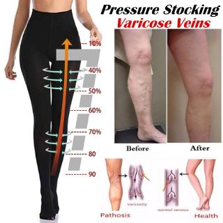 Buy stockings varicose veins Online With Best Price, Mar 2024