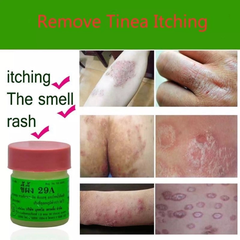 29A Cream Antifungal Antimicrobial Wax Ointment Shopee Malaysia