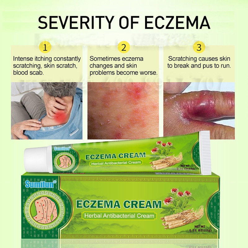 Itchy, Eczema, Eczema, Eczema, Water Acne, Leech Nest, Safe And