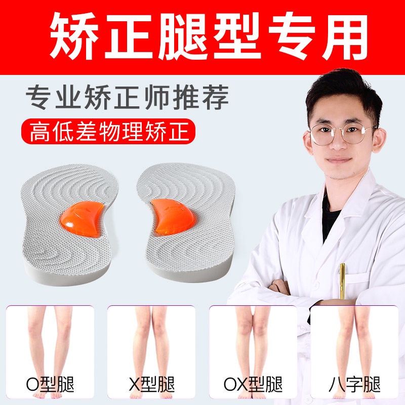 Oshaped Leg Correction Insole xoShaped Leg xShaped Leg Correction