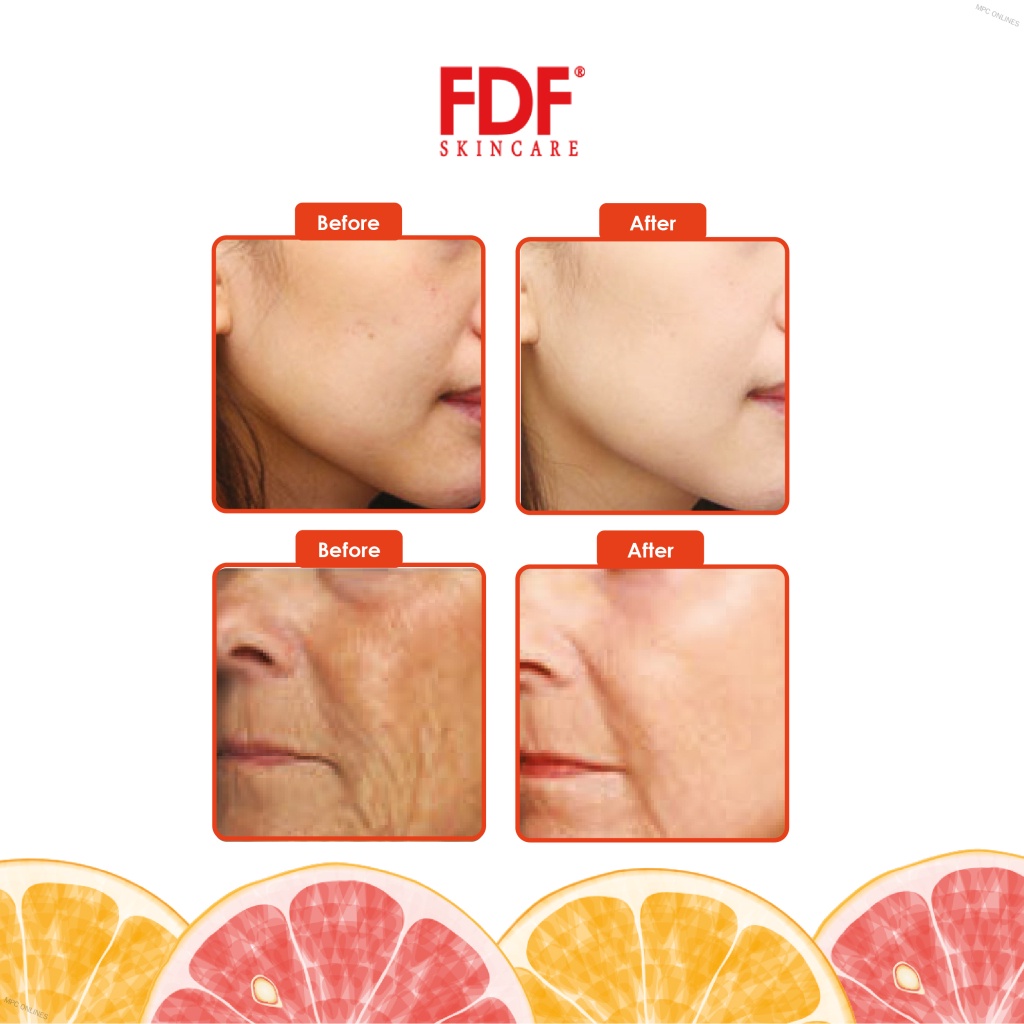 MPC ONLINES Fdf Skincare Travel Set With Free Product Sample | Shopee ...