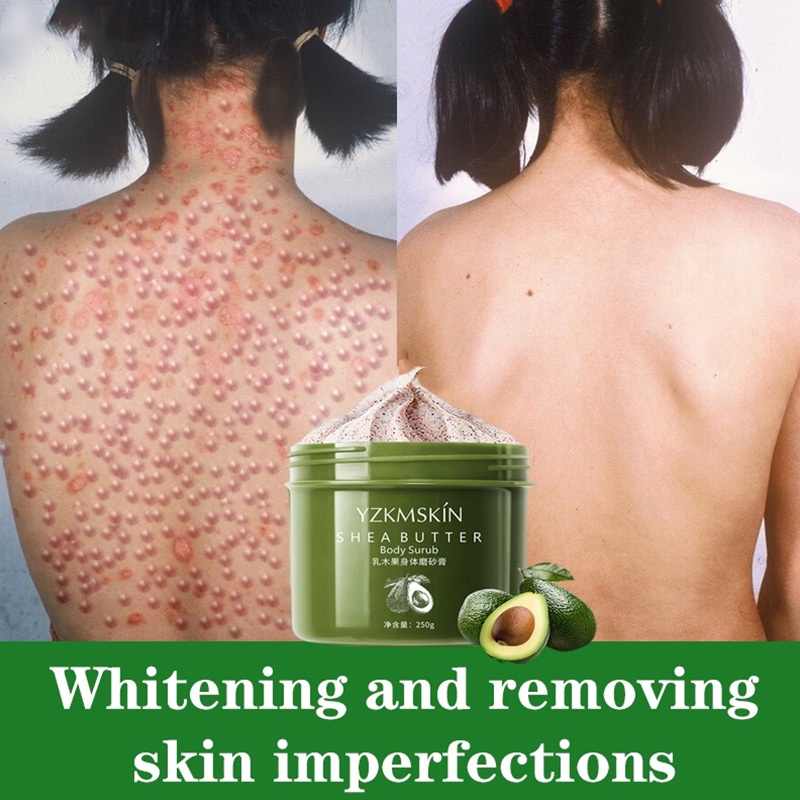 Whitening Exfoliating Body Scrub Jerawat Beautetox Lulur Mandi Exfoliating 7 Days Quickly Remove