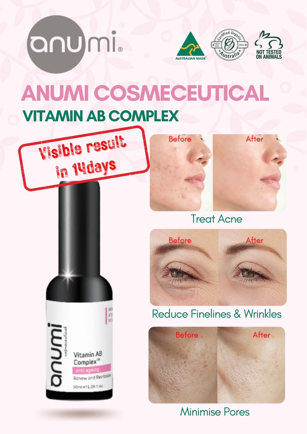 ANUMI FACE SERUM VITAMIN AB COMPLEX 30ML RENEW AND REVITALISE | Shopee ...