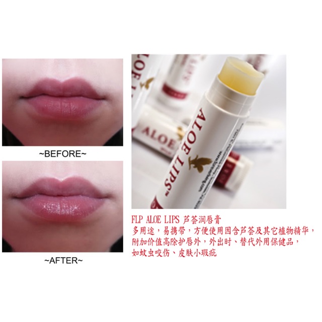 💯NATURAL Forever Aloe Lips palm💋💧 | Shopee Malaysia