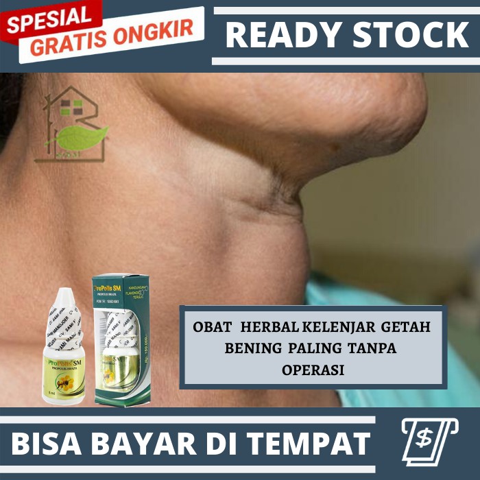 Medicine for lymph nodes, lumps in the neck, swelling in the neck ...