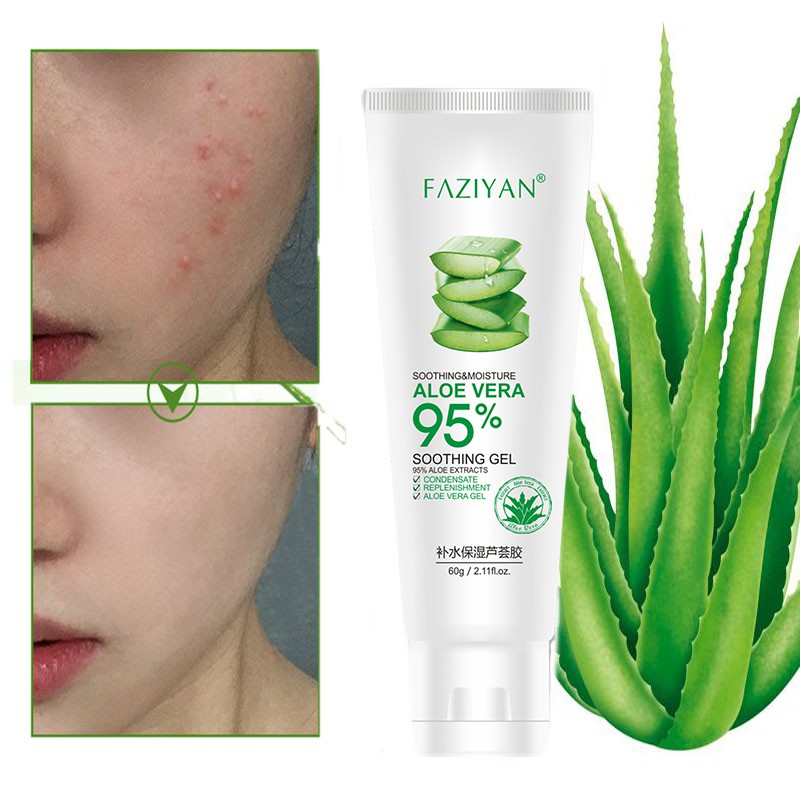 Aloe vera gel 100% hydrating moisturizing acne removal repair after sun ...