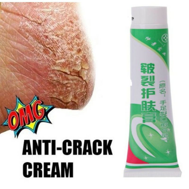 Ok ANTI CRACK CREAM Broken Heel Broken Rorombehen | Shopee Malaysia