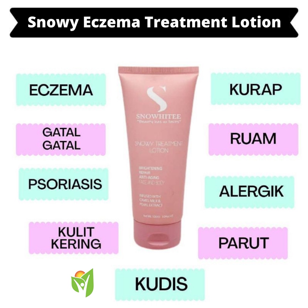 ECZEMA SNOWY TREATMENT LOTION - Losyen Susu Unta Ekzema, Krim Gatal ...